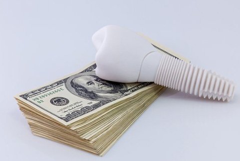 A giant dental implant model sitting on top of a stack of dollar bills