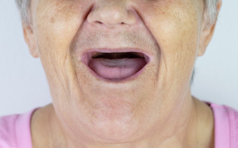 A closeup of an elderly woman with no teeth